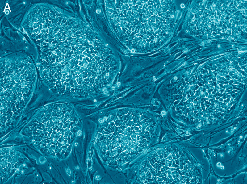 800px-Human_embryonic_stem_cells_only_A.png