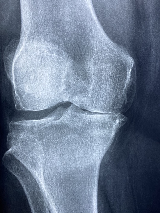 knee-5314881_960_720.jpg