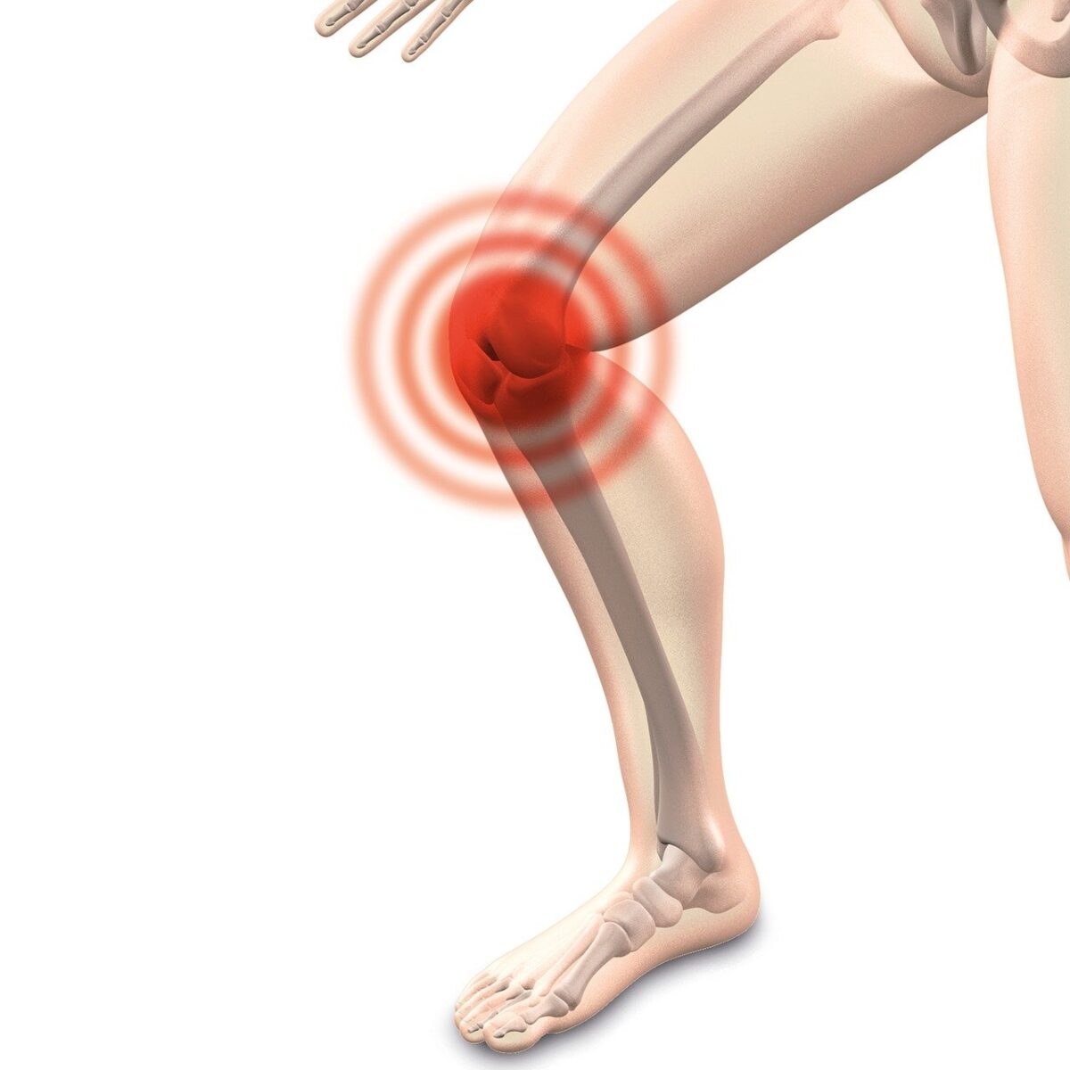 arthrocalman-2384253_1280-1200x1200.jpg